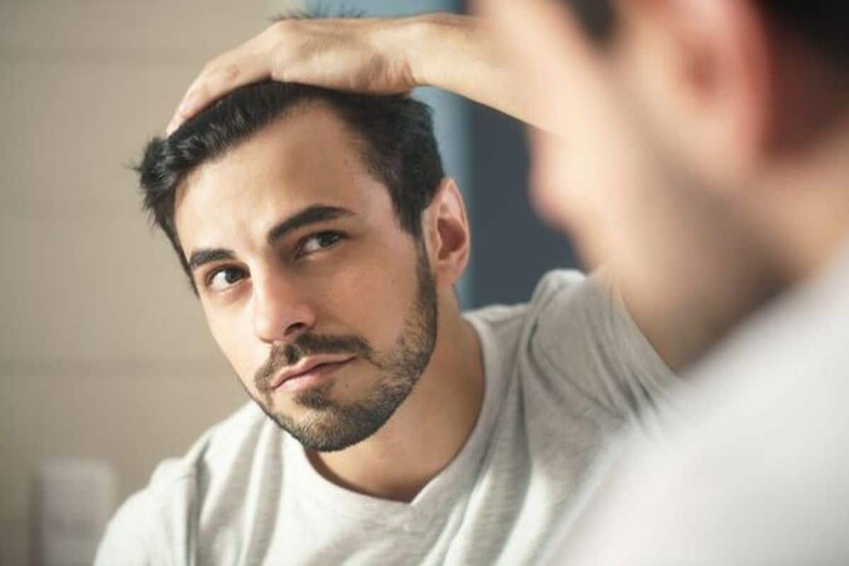 hair-loss-problem-in-men:-पुरुषों-में-बाल-झड़ने-की-समस्या-के-5-कारण