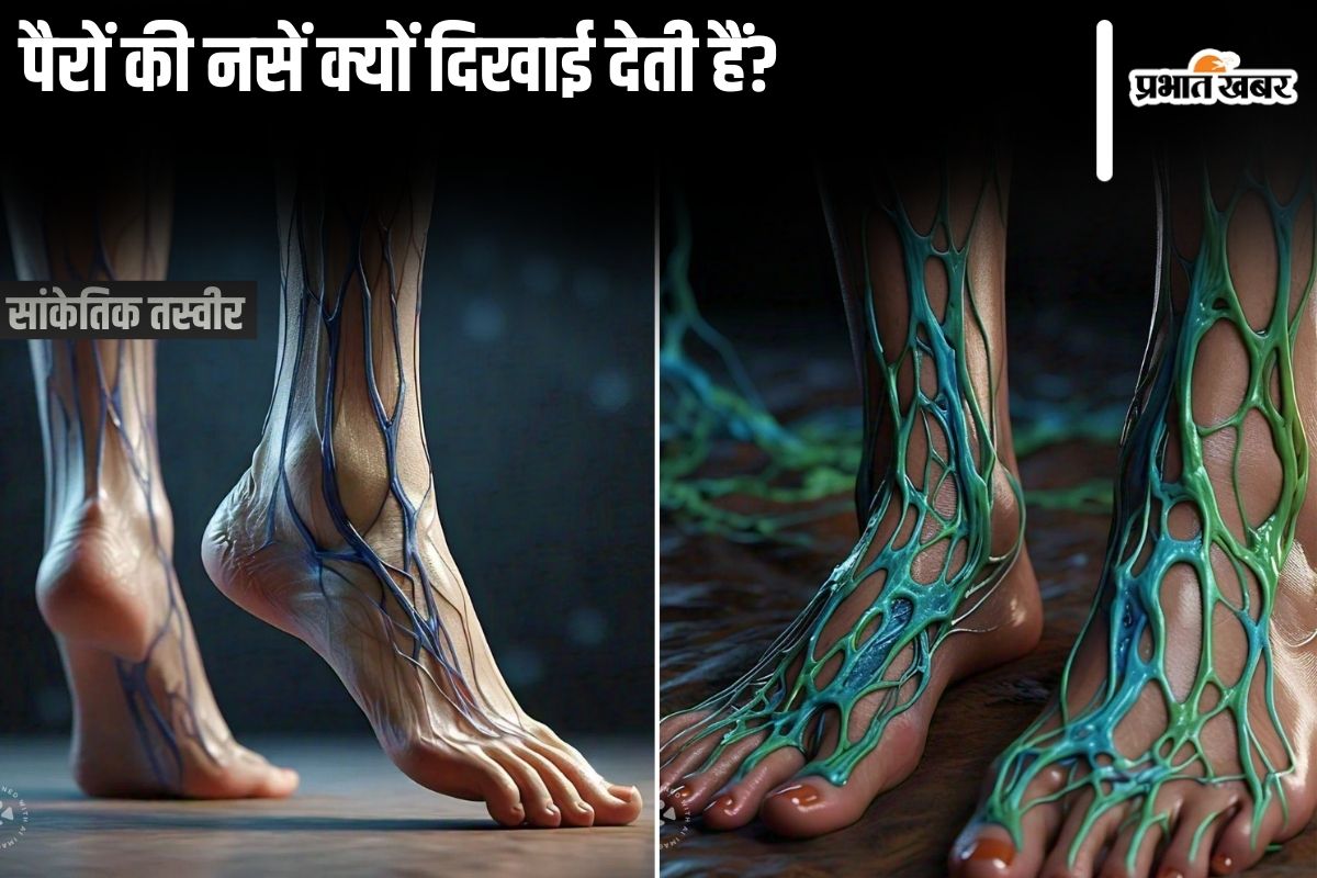 visible-leg-veins:-पैरों-की-नसें-क्यों-दिखाई-देती-हैं?